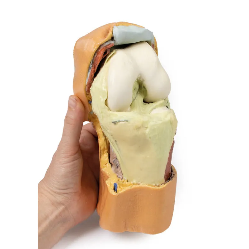 3D Printed Flexed knee joint deep dissection Model